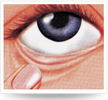 頭仰后，用食指將下眼瞼下拉，使其成袋狀